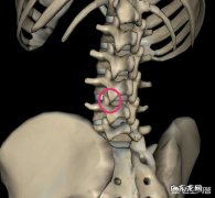 头痛、背痛、腰颈疼痛…这些中老年人的常见疼痛怎么办？