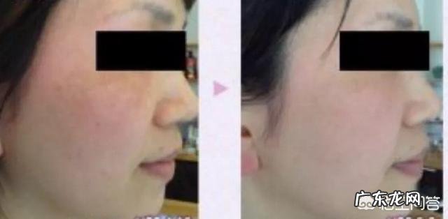 吃胶原蛋白粉有什么好处？