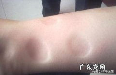 怀孕34周腿肿会是血糖高的原因吗？