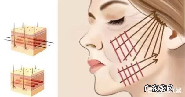 现在流行的线雕美容有近期和远期危害吗？