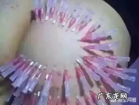 现在流行的线雕美容有近期和远期危害吗？