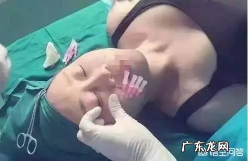 现在流行的线雕美容有近期和远期危害吗？