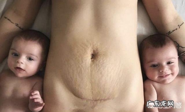 剖腹产伤口怎么护理?什么时候开始瘦身?