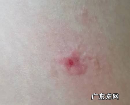 被黄蜂蛰了怎么办?常见中草药敷敷见效快!