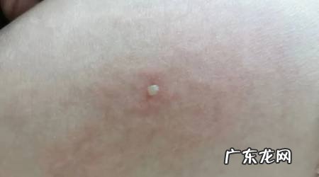 被黄蜂蛰了怎么办?常见中草药敷敷见效快!