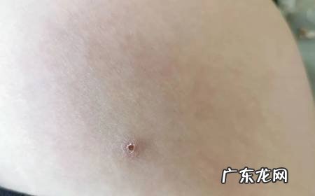 被黄蜂蛰了怎么办?常见中草药敷敷见效快!