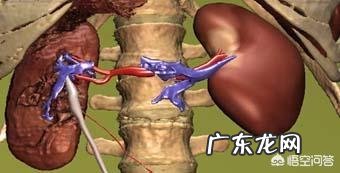 IgA肾病有多少几率会发生肾衰?