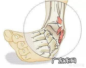 为什么有的人的踝关节容易扭伤