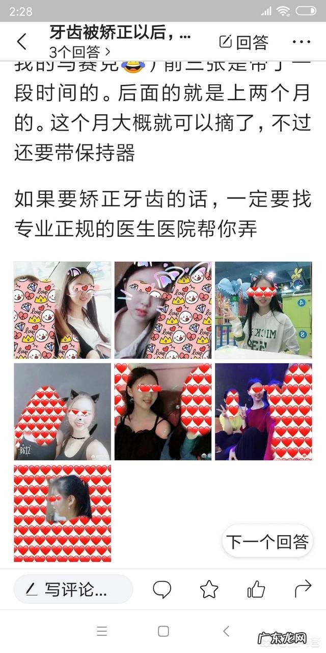 做过牙齿矫正的同学们,你们的脸型变了吗