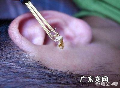 孩子三岁了,耳朵里有耳屎能挖干净吗