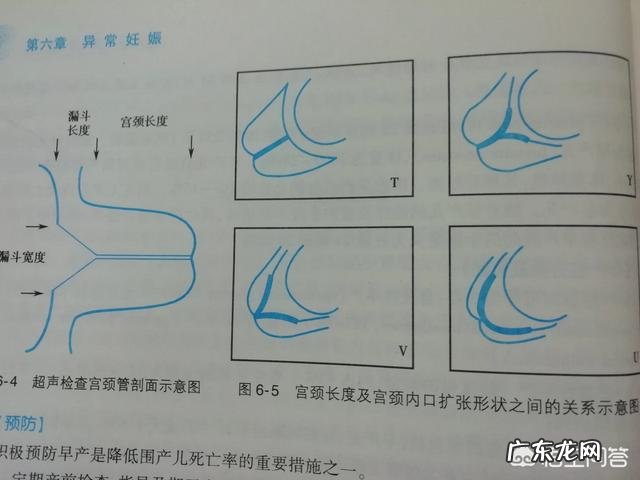 什么是高危妊娠需要注意哪些