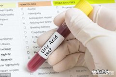 尿酸高不降，会导致肾衰吗有哪些食物是高尿酸要忌口的