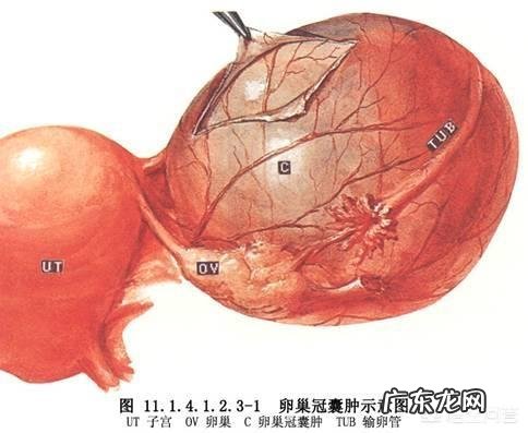 五十多岁做了卵巢囊肿手术后来月经吗？