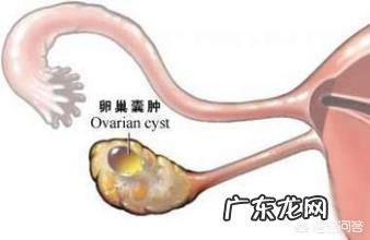 五十多岁做了卵巢囊肿手术后来月经吗？