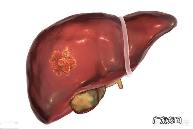 胆结石、胆管结石手术后服什么食物比较好