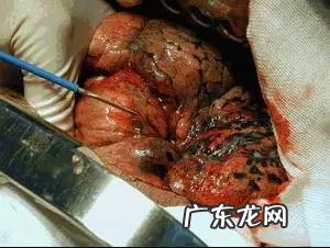 男人应该如何戒烟请高手出招