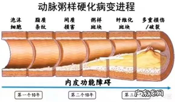 冠心病高血压患者平时吃什么比较好？