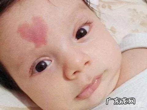 宝宝的胎记跟妈妈有关系吗?怎样避免孩子长胎记?