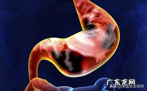 得了慢性胃炎要多久才能zhi好？ 慢性浅表性胃炎中药能zhi好么