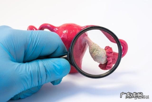 卵巢囊肿切除后复发怎么办?