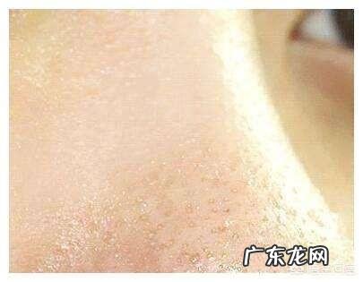 你会经常给皮肤去角质吗，你对去角质怎么理解