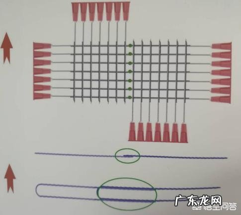 埋线做完表情夸张蛋白线会断掉吗？