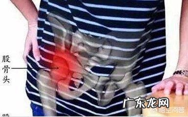 髋关节疼痛是股骨头坏死了吗股骨头坏死有哪些表现