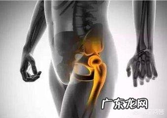 髋关节疼痛是股骨头坏死了吗股骨头坏死有哪些表现
