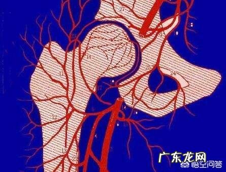 髋关节疼痛是股骨头坏死了吗股骨头坏死有哪些表现