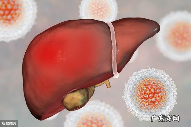 得了脂肪肝在饮食方面要注意些什么
