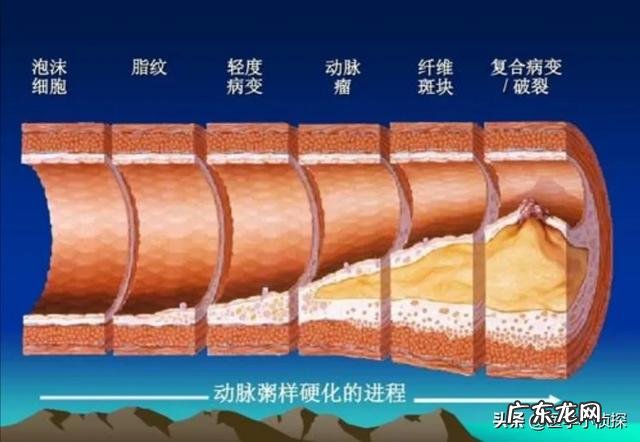 甲状腺手术有哪些后期影响