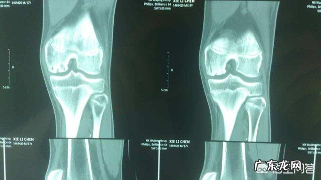 膝关节骨质增生,软骨能再生修复吗?