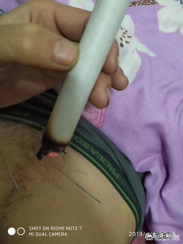 有糖尿病的人能用艾灸吗?