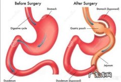 做了甲状腺手术后，身体发胖是为什么该如何zhi疗
