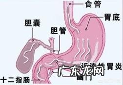 胆汁反流是什么原因导致的?
