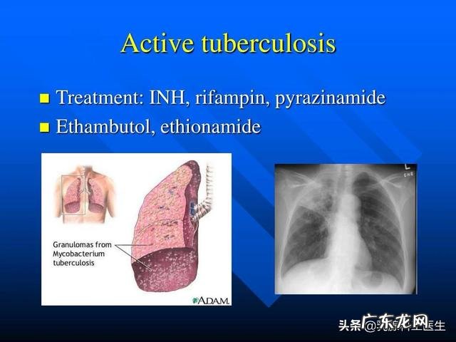 环磷酰胺是一种什么样的神药，他能够zhi癌症？