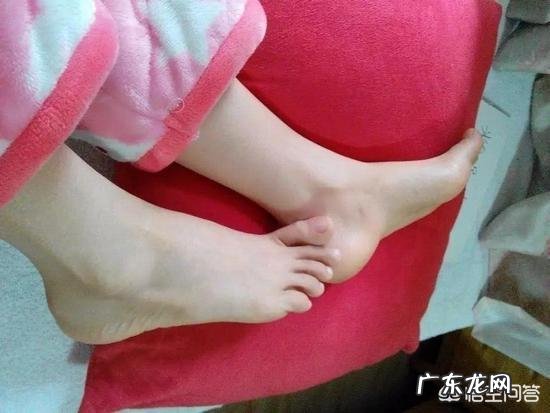 脚底起黄色的硬皮,该怎么办