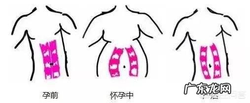 生完孩子之后容易腰疼怎么缓解呢?