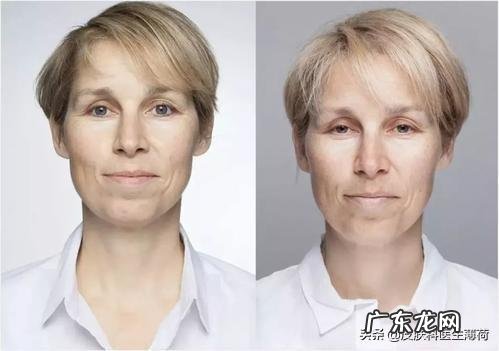 皮肤问题是缺少多种维生素吗?应该怎么补充维生素呢?