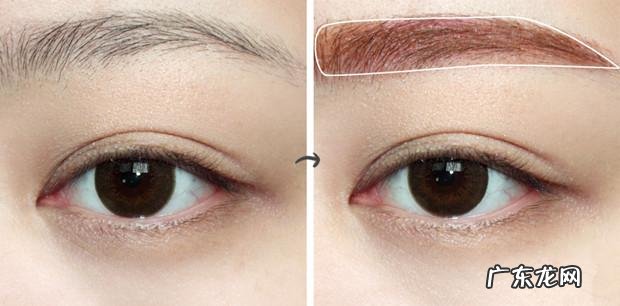 女生嘴角边的小胡子怎么去除 女孩嘴上小胡子怎样去除?