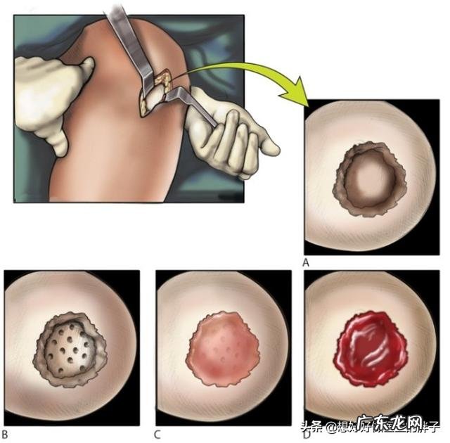 胖子跑步伤膝盖吗是和体重有关吗