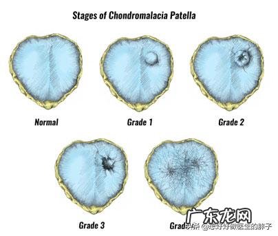 胖子跑步伤膝盖吗是和体重有关吗
