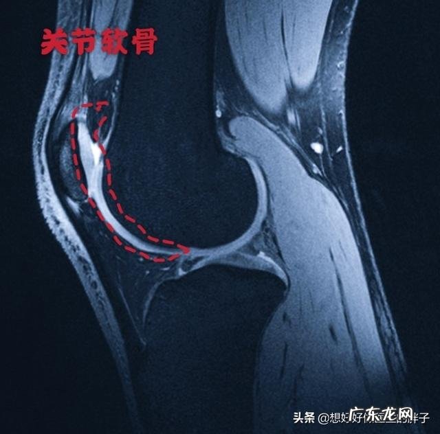 胖子跑步伤膝盖吗是和体重有关吗
