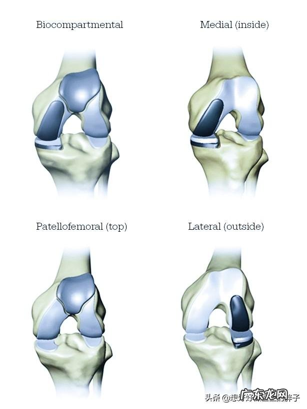 胖子跑步伤膝盖吗是和体重有关吗