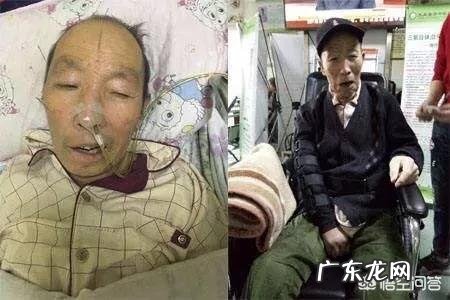 脑梗后为什么有些患者会越来越瘦？