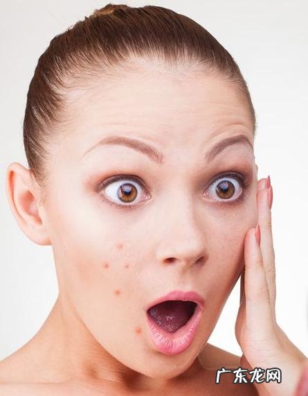 泰尔丝 都说异维a是特效药,为什么我吃了痘痘反而增多了?