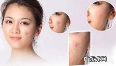 疤痕为什么不能完全祛除？还有可能发明出完全祛除疤痕的药物吗？