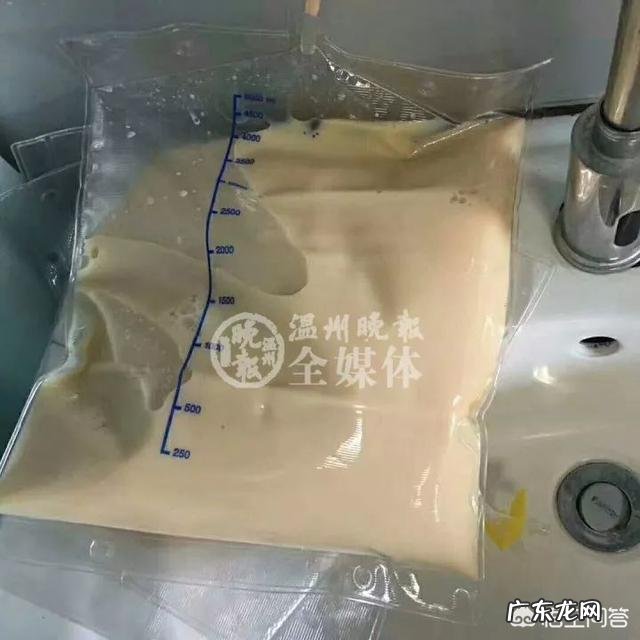 合肥420斤男子做切胃减重手术2年200斤，你怎么看