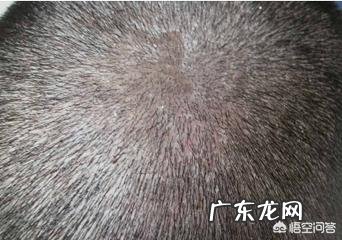 牛皮癣,白癜风,银屑病,脂溢性皮炎,相同处与不同之处是什么