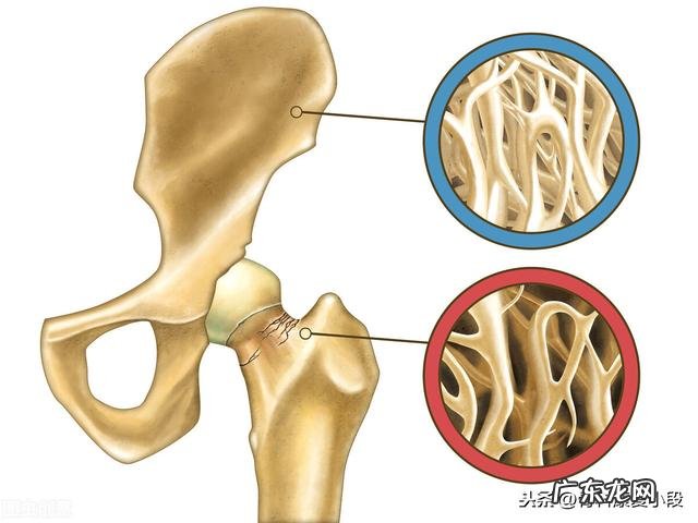 中年人如何增强自己的骨密度